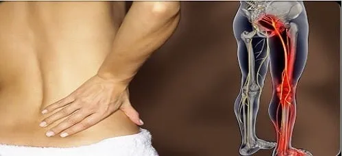 ciático