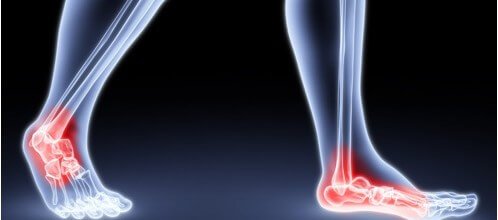fisioterapia ortopédica
